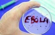 В Шотландии зафиксирован случай заражения вирусом Эбола