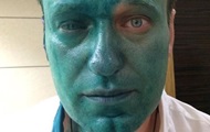 Навальный заявил, что может ослепнуть на один глаз от зеленки